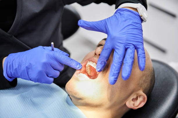 Emergency Gum Pain Relief in MD